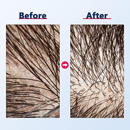 Meksitop češenje za vlasište silikonska šampon četkica za muškarce mokri dlaka za depaticiranje četkica