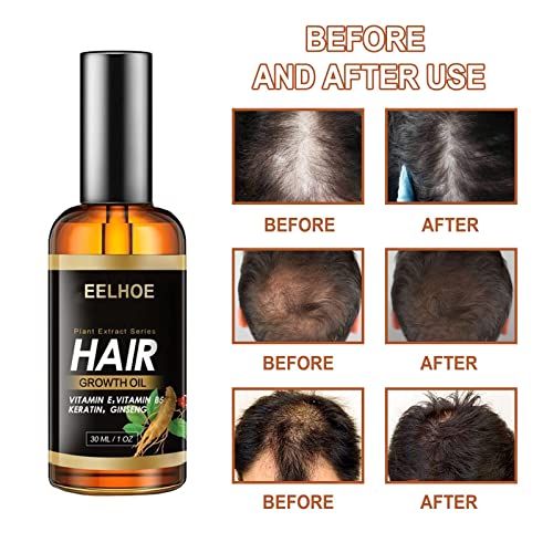 Suna Biljni ekstrakt ulje za rast kose, Suna ulje za rast kose, jegulja đumbir esencijalno ulje za rast kose, ulje za rast kose, za gubitak kose, kosa raste gušća i duža, brz rast kose